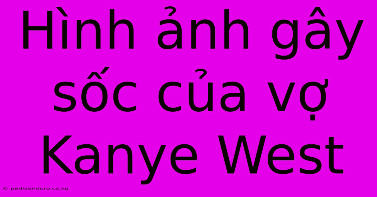 Hình Ảnh Gây Sốc Của Vợ Kanye West